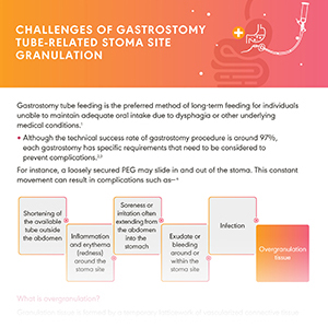 Challenges of stoma site granulation with gastrostomy feeding tubes