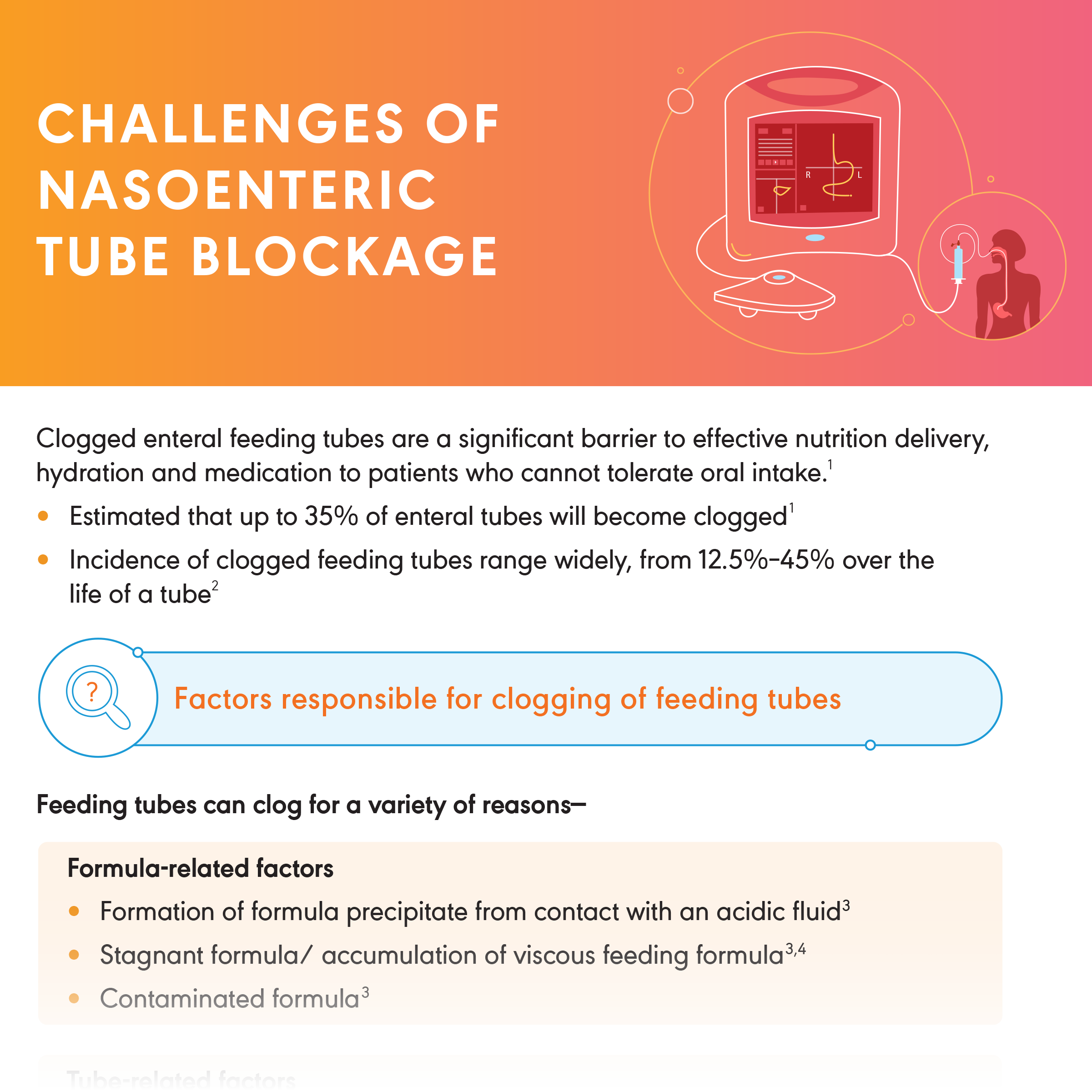 Challenges of Nasoenteric Tube Blockage