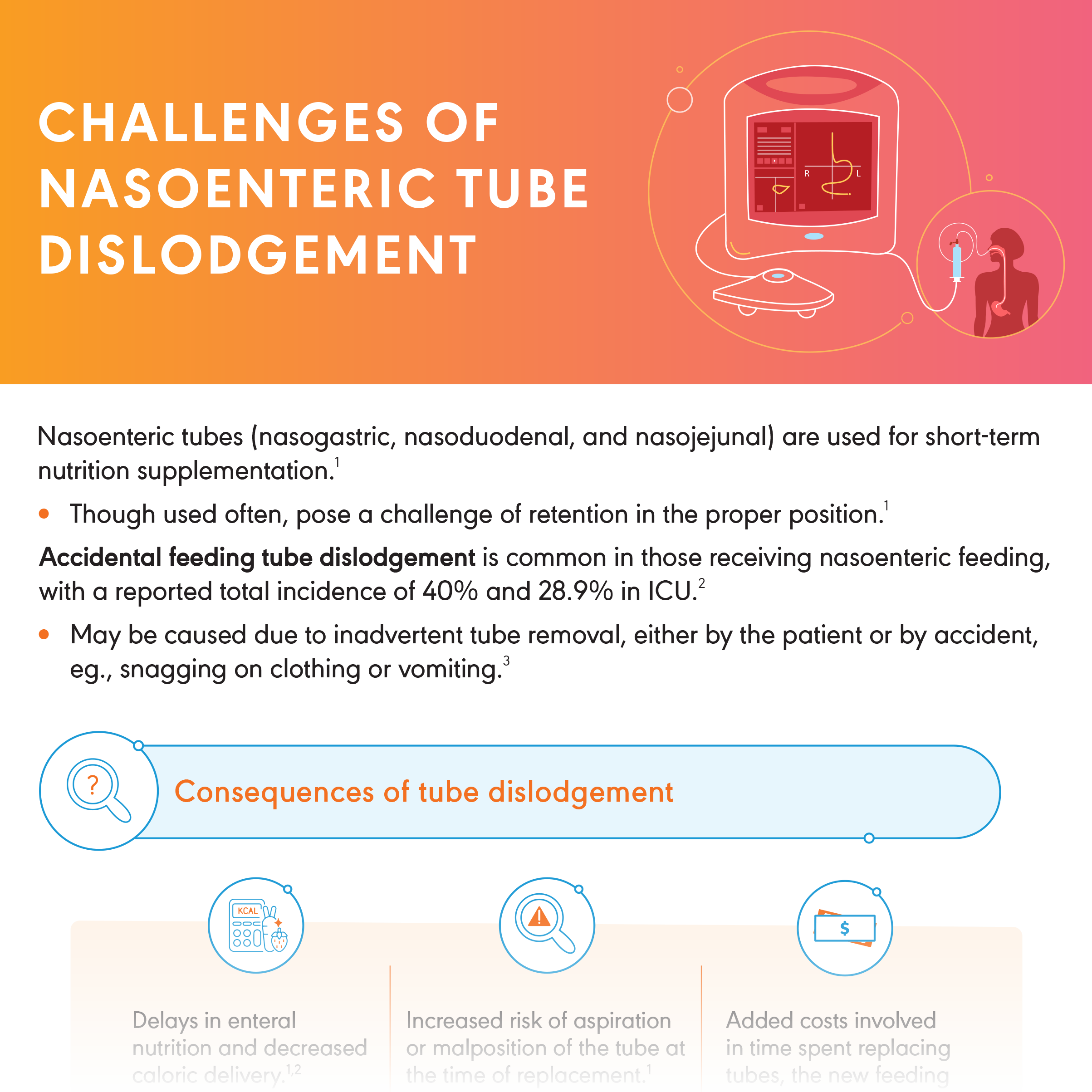 Challenges of Nasogastric Tube Dislodgement