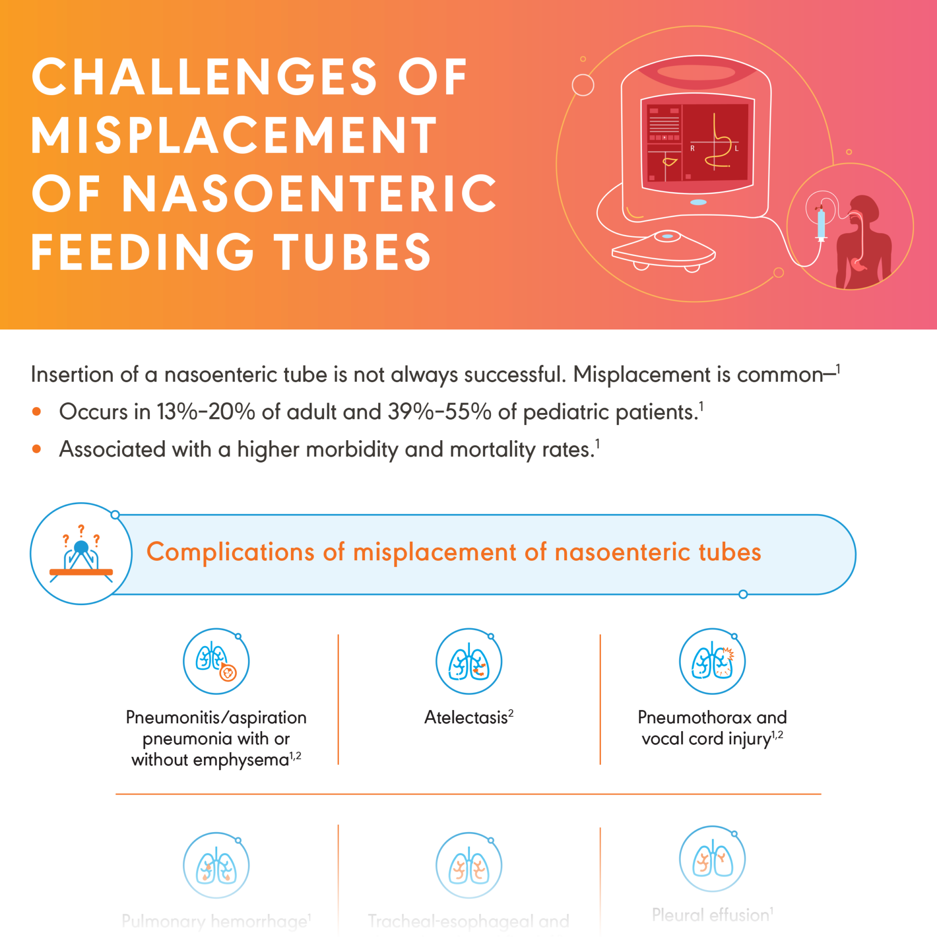 Challenges of Misplacement Of Nasoenteric Feeding Tubes