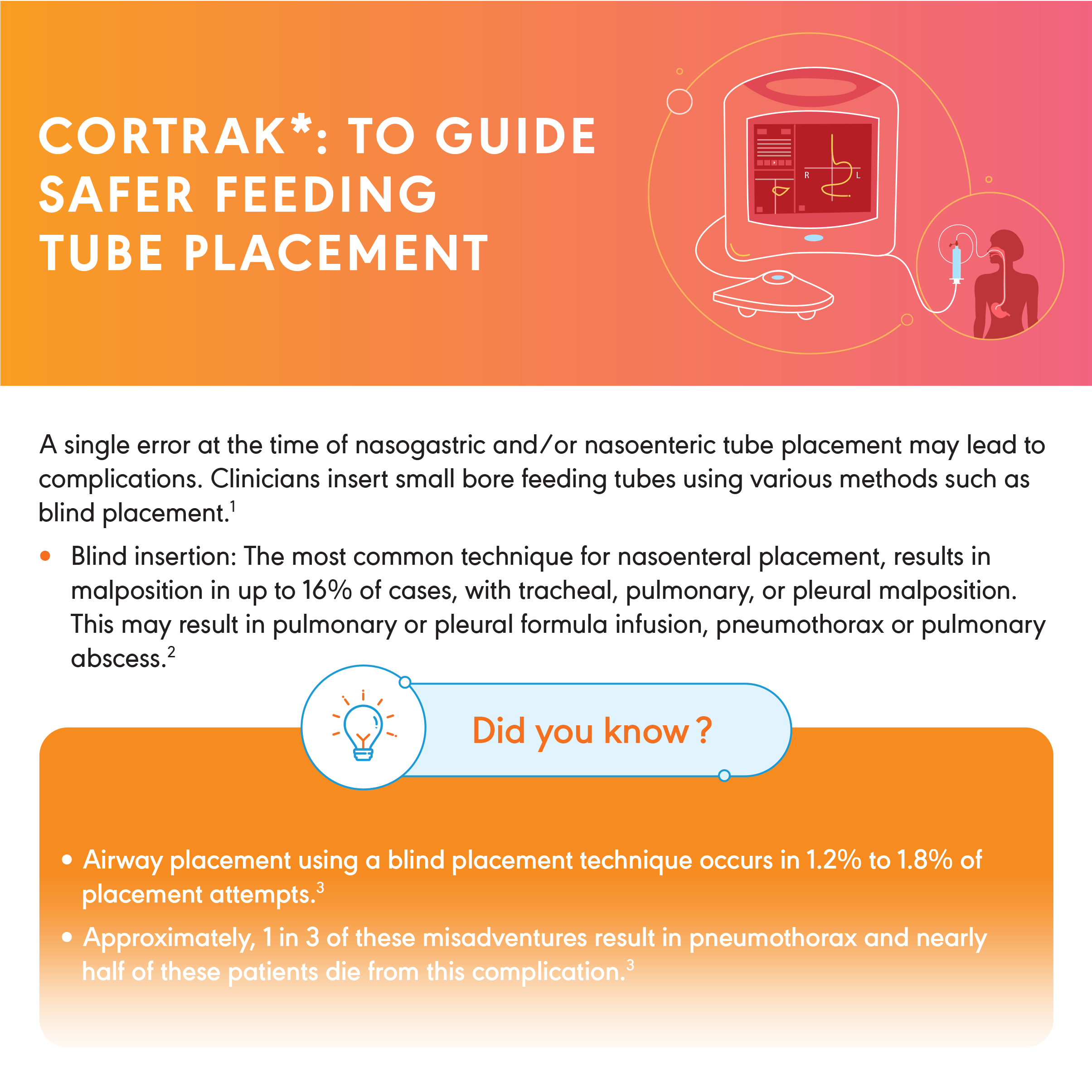 Cortrak: To Guide Safer Feeding Tube Placement